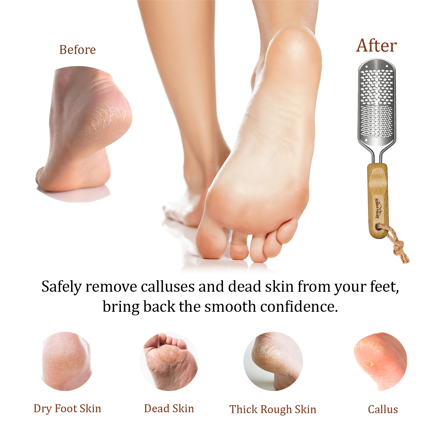 Foot Scraper File Hard Skin Remover Foot Callus Shaver Pedicure Foot Rasp  Heel Corn Removal Foot